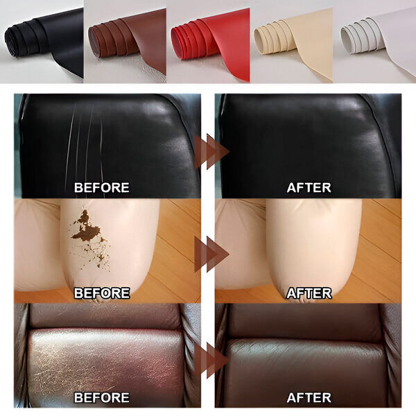 KOŽAFIX – Samolepljiva Popravka Kože (40x300 cm)