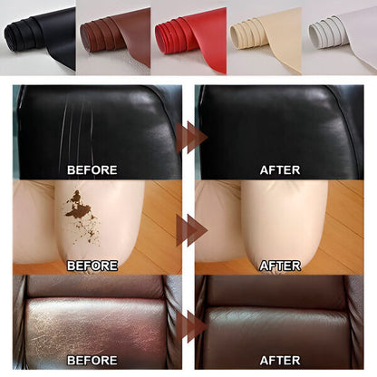 KOŽAFIX – Samolepljiva Popravka Kože (40x300 cm)